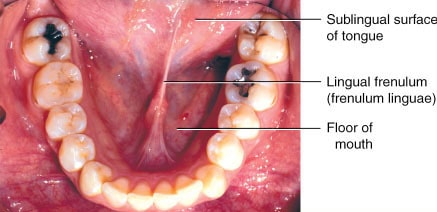 জিহ্বা frenulum, লিংগা frenulum